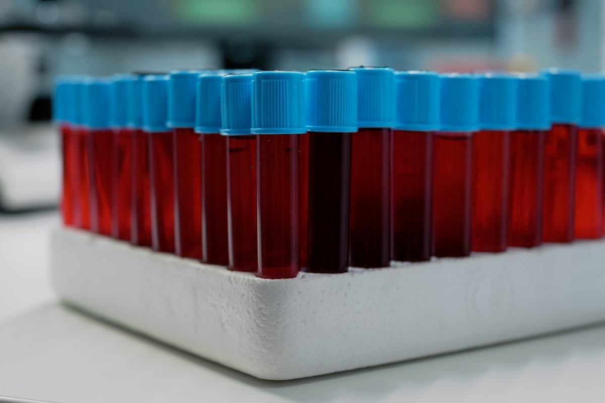 Röhrchen mit Blutproben auf einem Tablett im Labor